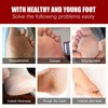 5 Pieces Exfoliating Foot Peel Mask Hydrating Moisturizing Smoothing for