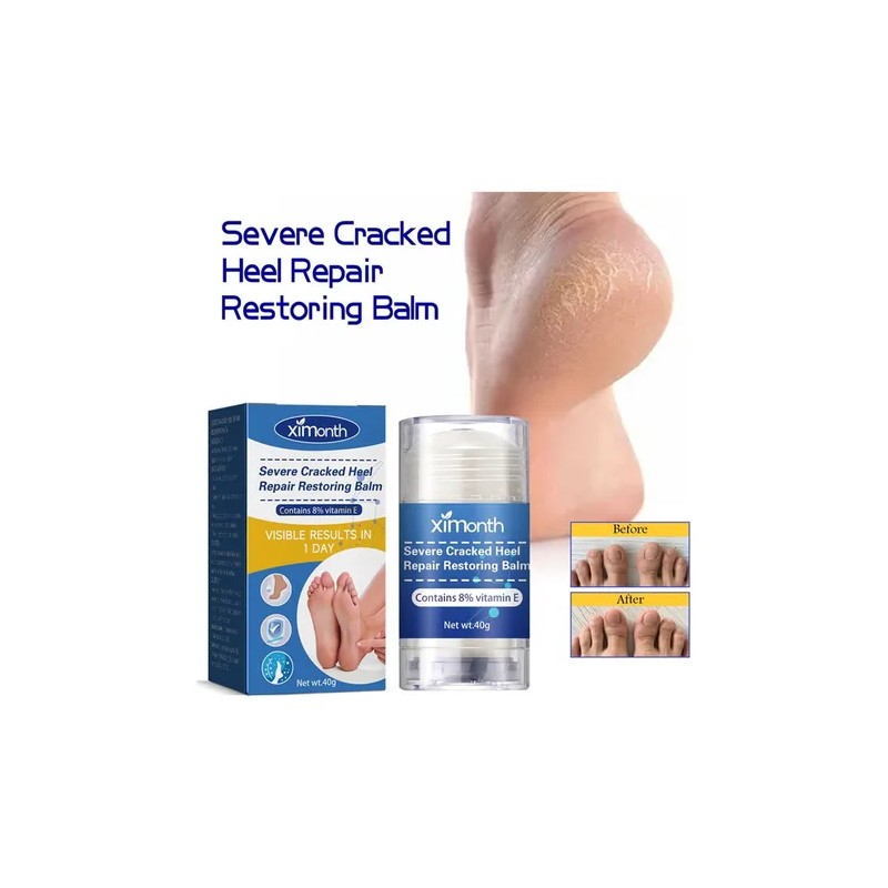 2×crema Reparadora Grietas Secas Y Talones For Pies Y Mano