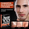 Men's Blackhead Pore Strips - 120 Deep Cleansing Facial Nose
