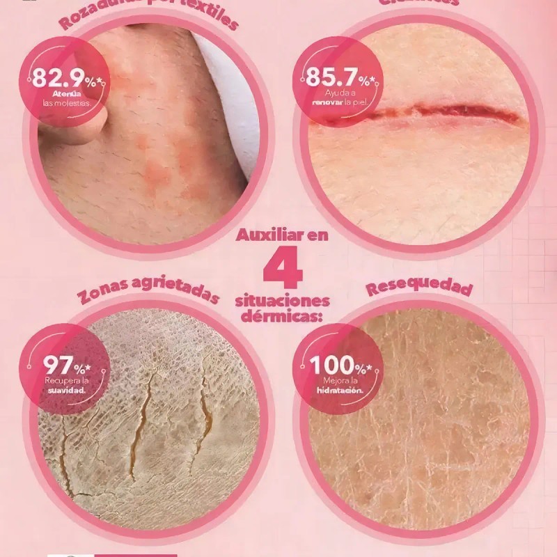 Pomada Magica Crema Reparadora Arnica Y Calendula Stanhome