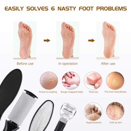 Queta 16 Pcs Professional Pedicure Set Foot Care Tools Dead Hard Skin with Scraper/Callus Remover/Rasp,Pedicure and Manicure