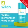 Witch Witch SOS Blemish Stick, fights bacteria, works instantly, reduces