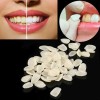 Unbranded 96PCS/Card Dental Tooth Veneer Anterior Resin Thin Teeth Veneers