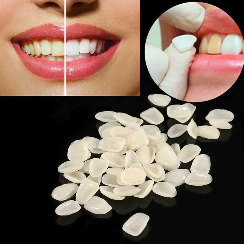 Unbranded 96PCS/Card Dental Tooth Veneer Anterior Resin Thin Teeth Veneers