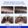 2 Pcs Anti-Dandruff Shampoo, Oil Control and Refreshing Formula, Hair