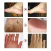 R Crema De Pies Con Hierbas Y Exfoliante Para Talones
