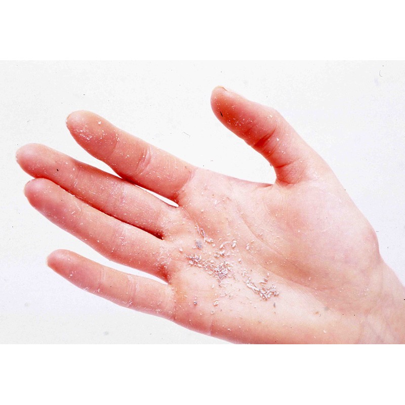 Tommy Rich Akasuri Agassi