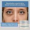 Contorno De Ojos: Acido Hialurónico +colageno Arrugas Ojeras
