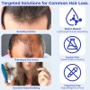 Serum Para El Crecimiento Del Cabello Eoiroa Con 3% De