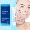 Retinol Gel Anti Acne Treatment – Retinol Acne Treatment Gel