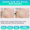 CELDYQUE Azelaic Acid 12% Facial Serum w/Niacinamide C Rapid Relief