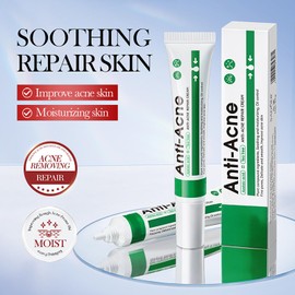 Anti Acne Cream with Salicylic Acid - Spot Treatment for Pimples, Blackheads & Blemishes - Oil-Free, Fast-Absorbing Spot Cream for Oily & Acne-Prone Skin - Pimple Cr-eam - A-cne Treatment - 20g