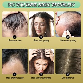 Ginger Plant Extract Hair Shampoo,Ginger Extract Shampoo,Polygonum Multiflorum Hair Strengthening Shampoo,Hair Care Plant Shampoo,Hair Thickening Shampoo for Women Men (3PCS)