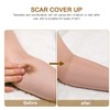 FOMIYES Waterproof Scar Concealer Tape, Invisible Skin Tone Cover up