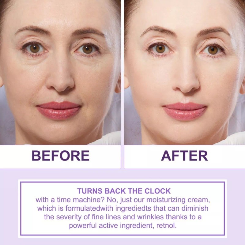 Elbbub Crema Antiarrugas Retinol 2.5% Té Verde Aloe Vera Rejuvenece