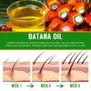 Batana Oil for Hair, 60 ml Batana Oil for Scalp,