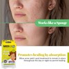 MEDca Acne Pimple Master Patch Absorbing Cover 24 Count Three Sizes