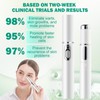 Pickelmale Entfernen, Pickelentferner, Blue Light Acne Treatment, Blaulicht Akne Entferner,