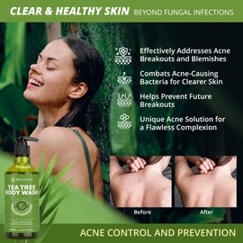 RoyceDerm Tea Tree Body Wash & Soap: Skin Care for Body Odor, Back Acne, Folliculitis, Tinea Versicolor, Jock Itch, Athlete’s Foot, and Ringworm - Gentle Cleansing with tea tree oil for Men & Women