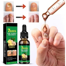 7 días de tratamiento de uñas de jengibre, ginger nail suero crecimiento de la uña de suero cuidado de la cutícula de jengibre aceite de uñas de jengibre para las uñas fortalecidas