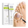 Compuesto completo para tratamiento de tiña Efero Nails, color blanco