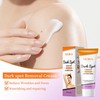 Moika Dark Spot Correcting Body Cream for Underarms, Elbows, and Knees 60g