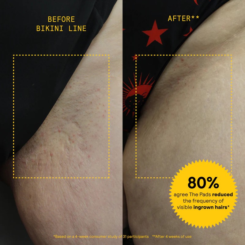 Meridian The Pads - 30 Pads