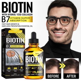 Mnozreo Haarwachstums-Serum,Schnell,Gegen Haarausfall und Haarwachstum,für Unisex-Erwachsene,30ML,1PC