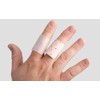 inocare Stacksche 386-5-11 Finger Splint for Buttonhole Fingers, Skin, Pack