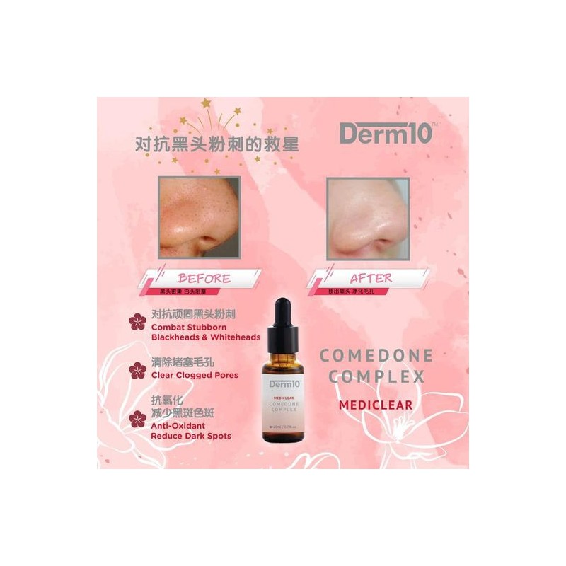 Derm10 Comedone Complex (20ml)