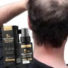 Tratamiento Regenerativo Cabello Calvicie Caida Natural 30ml