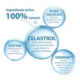 Shampoo Queratoreductor Ducray Kertyol P.S.O. 200 ml para Psoriasis y Descamación en Placas                                                           