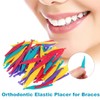 ZOKJSW Kieferorthopädische elastische Einweg Kunststoff Zahnspangen für Zahnspangen gemischte Farbe