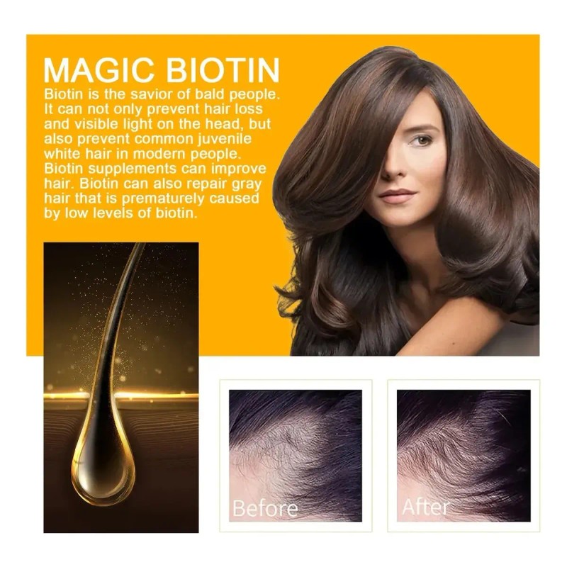 Sérum Capilar Eelhoe Biotina Crecimiento 30 Ml