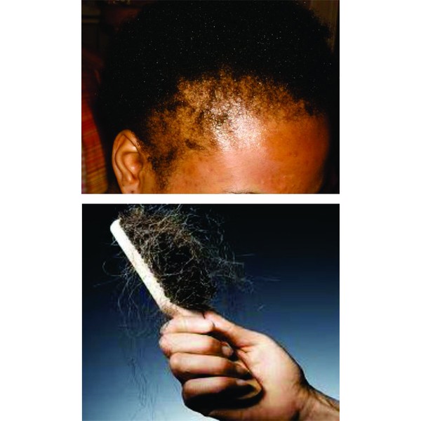 Nzuri Herbal Hair Wash Powder - Stop Hair Breakage
