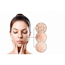 Skin Soother Gluten-Free Oatmeal Bath Treatment with Chamomile, Calendula and Aloe Vera for Eczema, Dry, Itchy, Irritated Skin. Use in Soap Making Supplies and Cosmetics