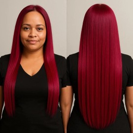 GS Hair Surgery Treatment for Red Hair /Cirugia Capilar para Cabello Rojo 33.8oz