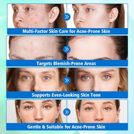 Acne Treatment Cream, Effective Acne Creams, Fast Acting Spot Cream, Reduces Blemishes & Breakouts, Blackhead Care, Spot Treatment for All Skin Types, Gentle Skin Care (20G)