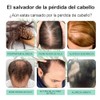 Aceite De Romero：Aceite de Romero para El Cabello-100%, Aceite Esencial