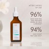 Moroccanoil Tratamiento Cuero Cabelludo Graso, 45 ml