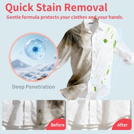 Etenpo 100pcs Stain Remover Wipe Individually Packaged Wipes Stain Remover for Clothes, Shoes and Sheets (5 pack of 100 wipes)