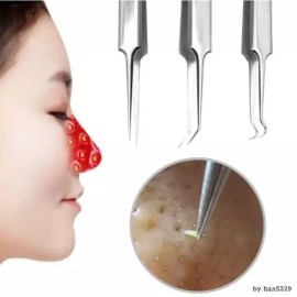 SS [에스에스_62]피지제거기 짜기 코 얼굴 블랙헤드 압출 바늘 [L형／FREE] [SS_62] Pore Extractor Blackhead Remover Needle for Face [L Size / FREE]