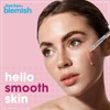 Bye Bye Blemish, Serum Resurfacing AHA + BHA Peeling, 30