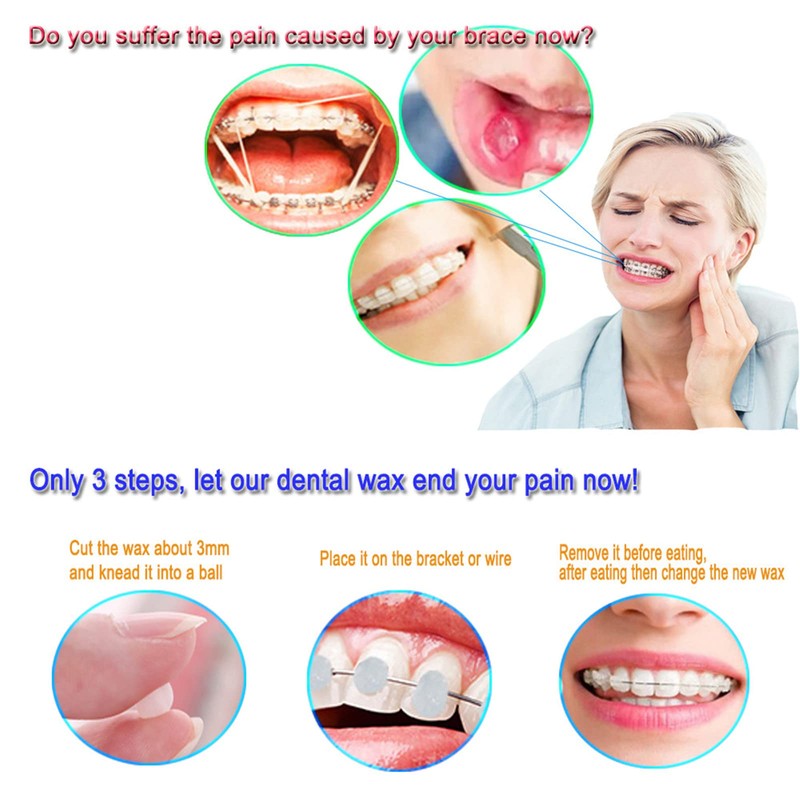 Dental Care Orthodontic Wax for Braces, 6 Pieces, 6 Colours