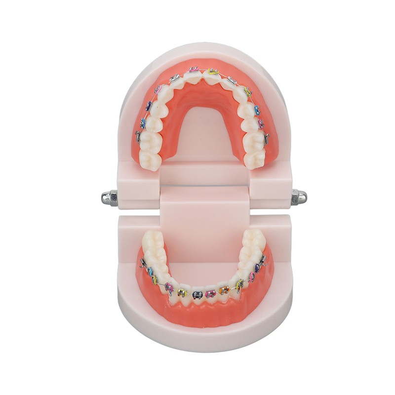 Dental Typodont Teeth Model with Orthodontic Metal Bracket for Dentist