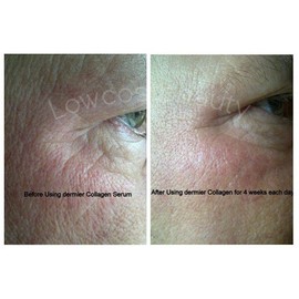 Skin Roller Collagen Serum 30 ml