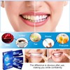 iwontalersy Pack of 14 Teeth Whitening Strips, Teeth Whitening Strips,