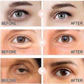 Ret-Inol Eye Cream For Face And Neck,Ret-Inol Eye Cream,Reti-Nol Firming Serum,Reti-Nol Ey-E Serum,Anti-Aging Lotion,Under Eye Brightener,For Dark Circles And Puffy Eyes,Reduce Fine Lines