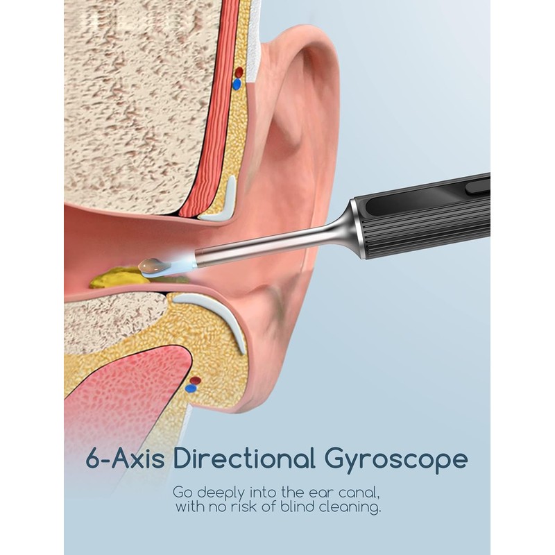 Qimic Ear Wax Removal, Ear Cleaner with Camera and Light,