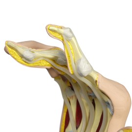 GPI Anatomicals - Human Anatomy Model of Right Hand with Rheumatoid Arthritis, Replica for Anatomy and Physiology Education, Anatomy Model for Doctor's Office and Classrooms, Medical Study Supplies